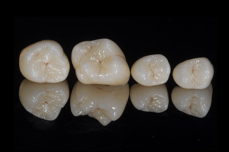 JDB电子:澳大利亚加宁巴塔钒钛磁铁矿等进展(图1) JDB电子游戏官网